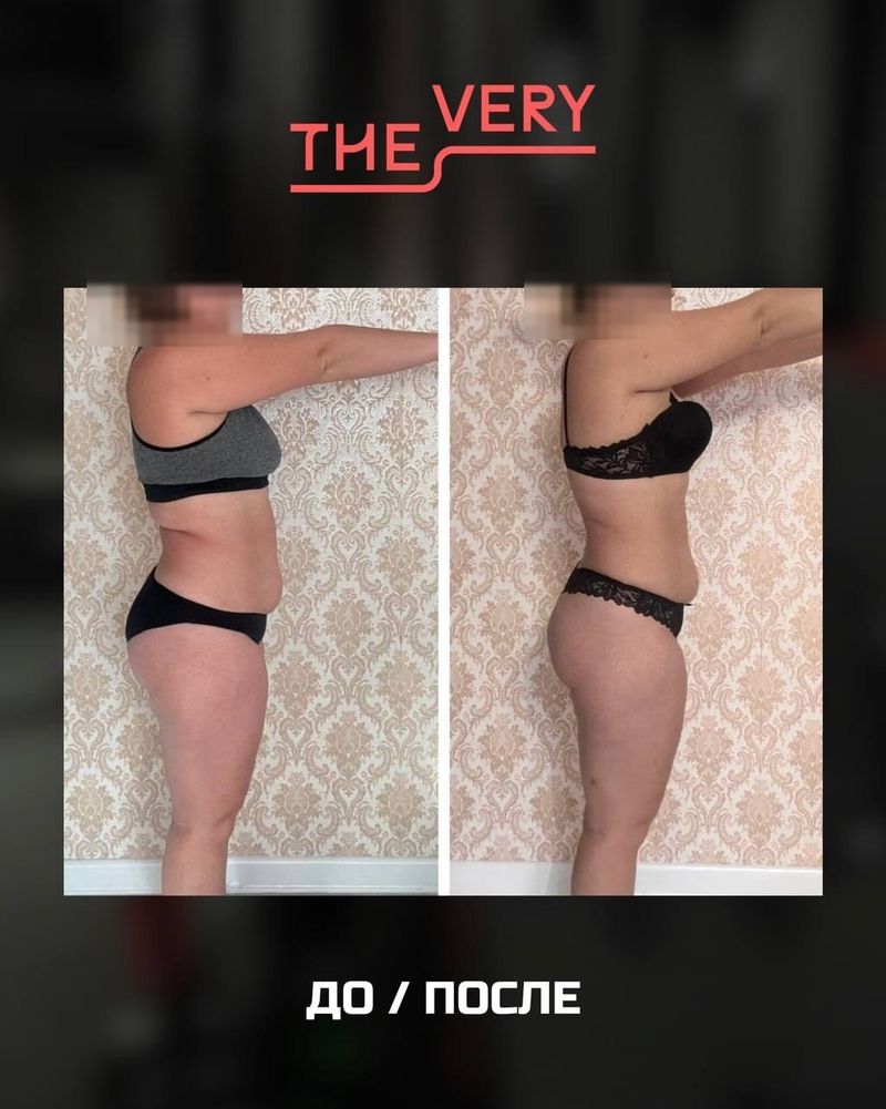 Результат гостьи THE VERY — до и после